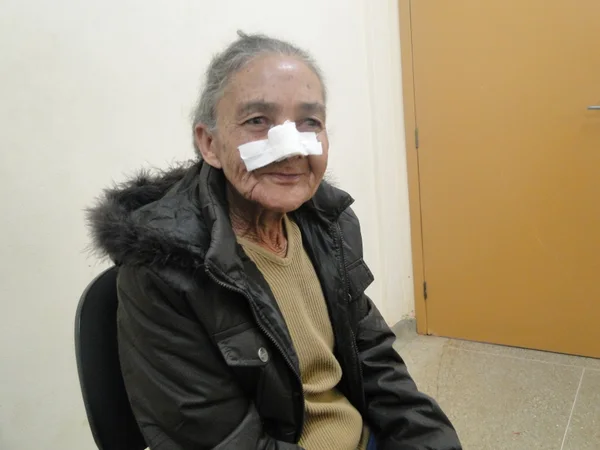 Maria Barbosa da Silva Santos, 66 anos, de Varzelândia, precisa fazer cirurgia de pterígio