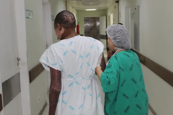 Minas amplia e estrutura rede de atenção à saúde dos pacientes queimados