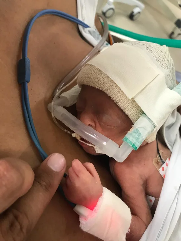 Família de bebê que nasceu pesando 600 gramas retorna à Maternidade Odete Valadares para agradecer equipe