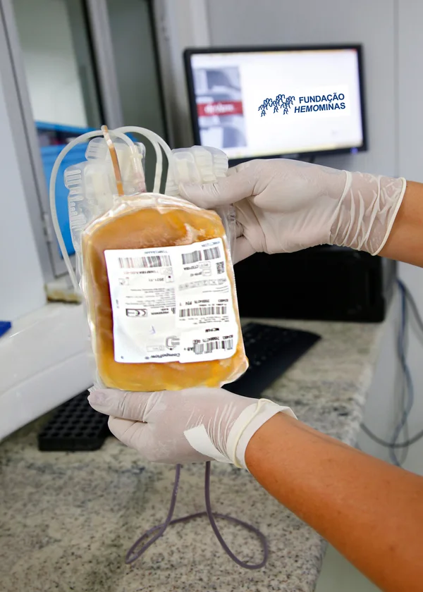 Governo de Minas amplia plasmaférese e fortalece o cuidado contra rejeição de órgãos transplantados 