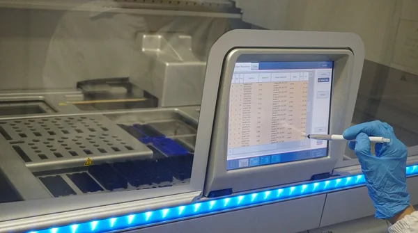 Exames têm importância epidemiológica, permitindo a confirmação dos primeiros casos e o monitoramento dos genótipos circulantes