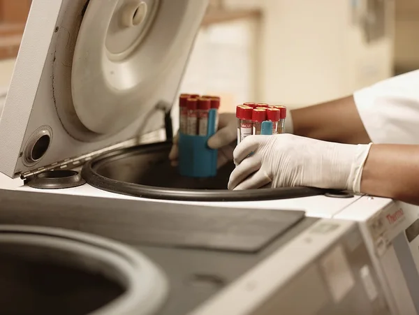 Beneficiários do Ipsemg podem realizar exames em 17 laboratórios de BH e região