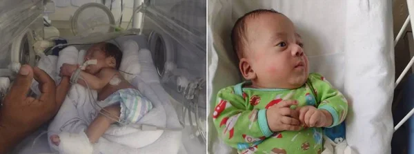 Bebê nascido prematuro vai para casa depois de passar os primeiros oito meses de vida internado 