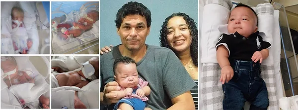 Bebê que nasceu com 867 gramas tem primeiro Dia das Mães em casa após mais de quatro meses no hospital