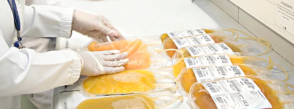 Governo de Minas amplia plasmaférese e fortalece o cuidado contra rejeição de órgãos transplantados 