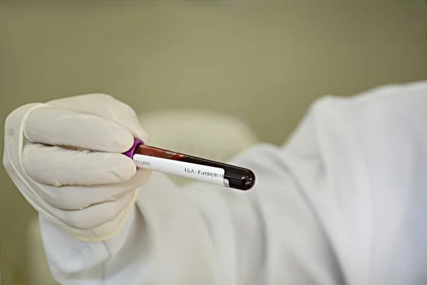 Governo de Minas passa a disponibilizar resultados de exames dos doadores de sangue no MG App