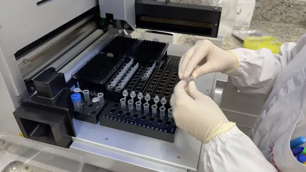 Janeiro Roxo: Governo de Minas fortalece combate à hanseníase com testes moleculares inéditos na rede pública