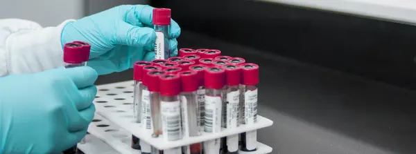 Secretaria de Saúde alerta para prevenção e sintomas no Dia Mundial de Combate à Meningite