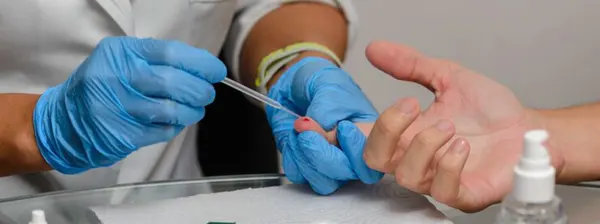 Secretaria de Saúde de Minas reforça importância da prevenção, testagem e tratamento precoce da sífilis