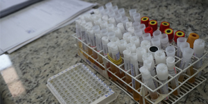 Unveil 8a21a6f614db065bb1ca2c21a5c803aede783f93e5277febbd47f37d9dbae4ca