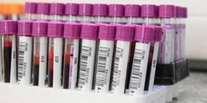 Unveil 8a21a6f614db065bb1ca2c21a5c803aede783f93e5277febbd47f37d9dbae4ca