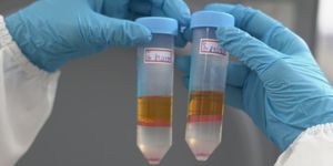 Unveil 8a21a6f614db065bb1ca2c21a5c803aede783f93e5277febbd47f37d9dbae4ca