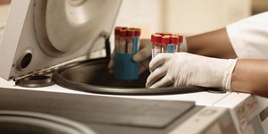 Unveil 8a21a6f614db065bb1ca2c21a5c803aede783f93e5277febbd47f37d9dbae4ca