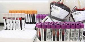 Unveil 8a21a6f614db065bb1ca2c21a5c803aede783f93e5277febbd47f37d9dbae4ca