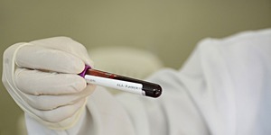 Unveil 8a21a6f614db065bb1ca2c21a5c803aede783f93e5277febbd47f37d9dbae4ca